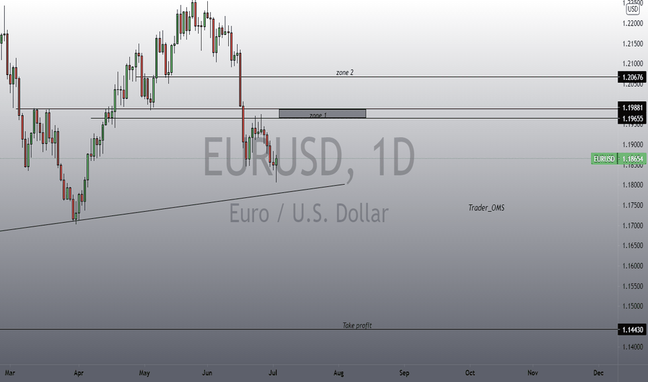 EURJPY big short