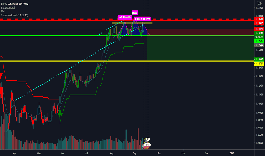 EUR/USD - Head & Shoulders Pattern