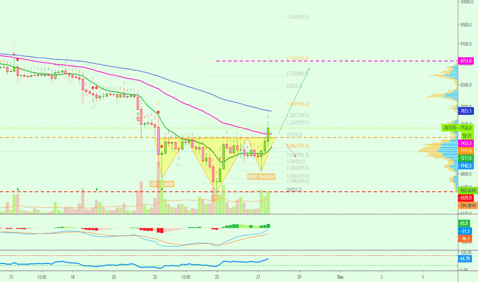 Bitcoin Bullish Inverse Head & Shoulders | $8500+ Now Possible!