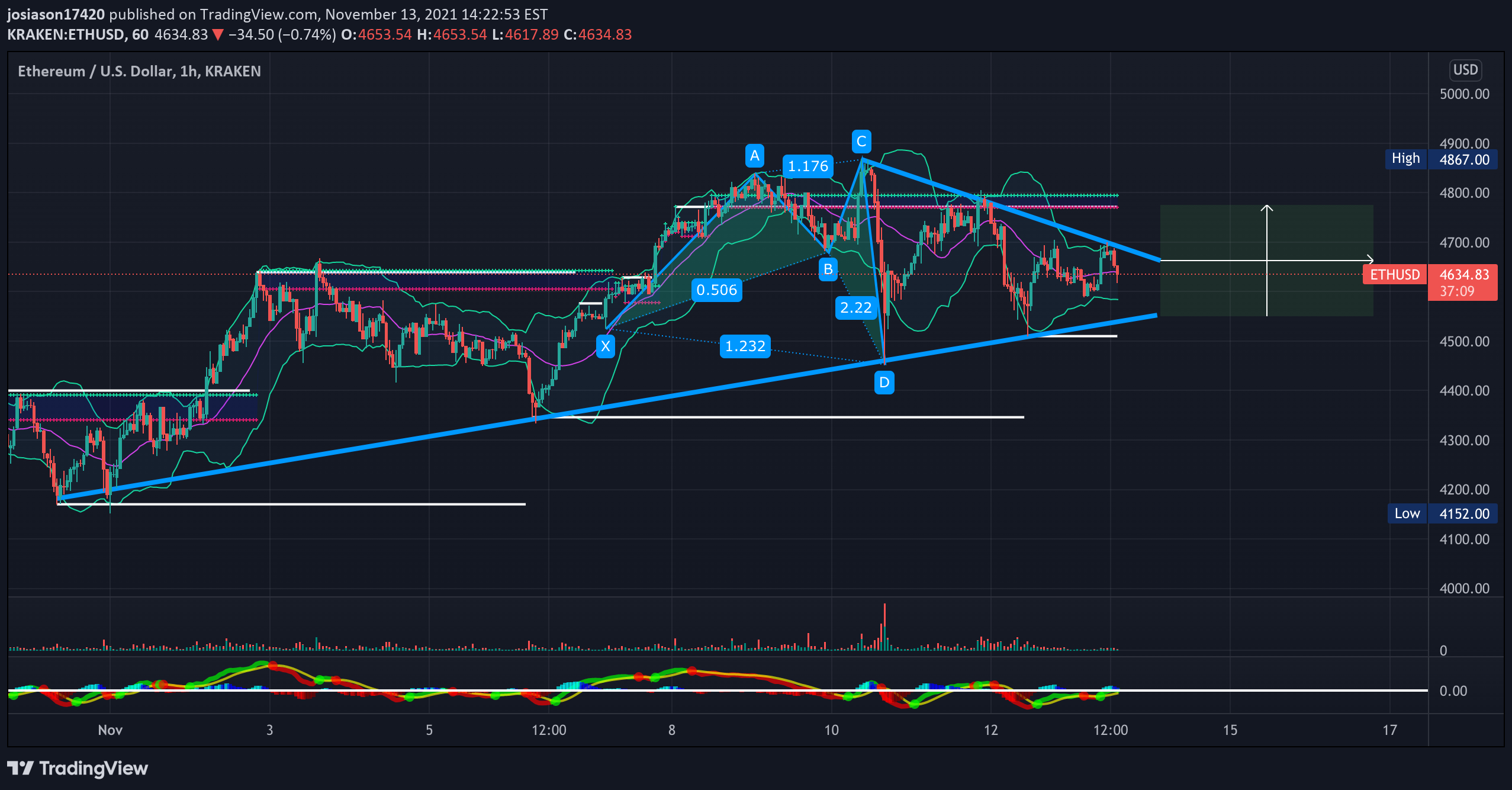 KRAKEN:ETHUSD Idea Chart Image by jacobosiason7