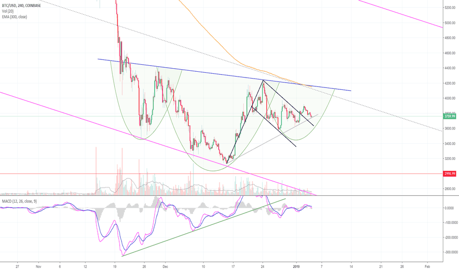 Important Levels To Watch in Bitcoin! (BTC)