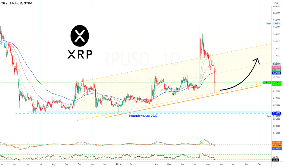 ✴️ XRP Since Last Year | Good & Bad News