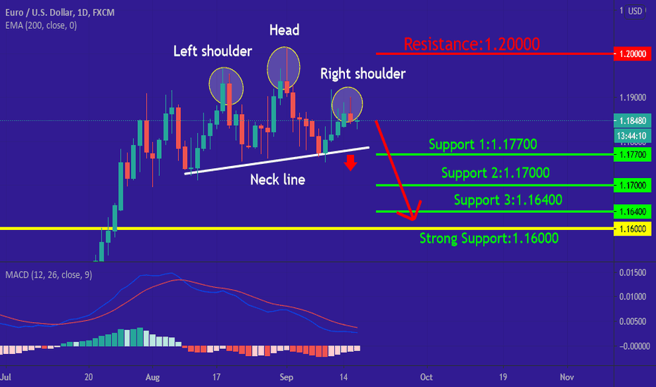 EUR/USD  in coming days