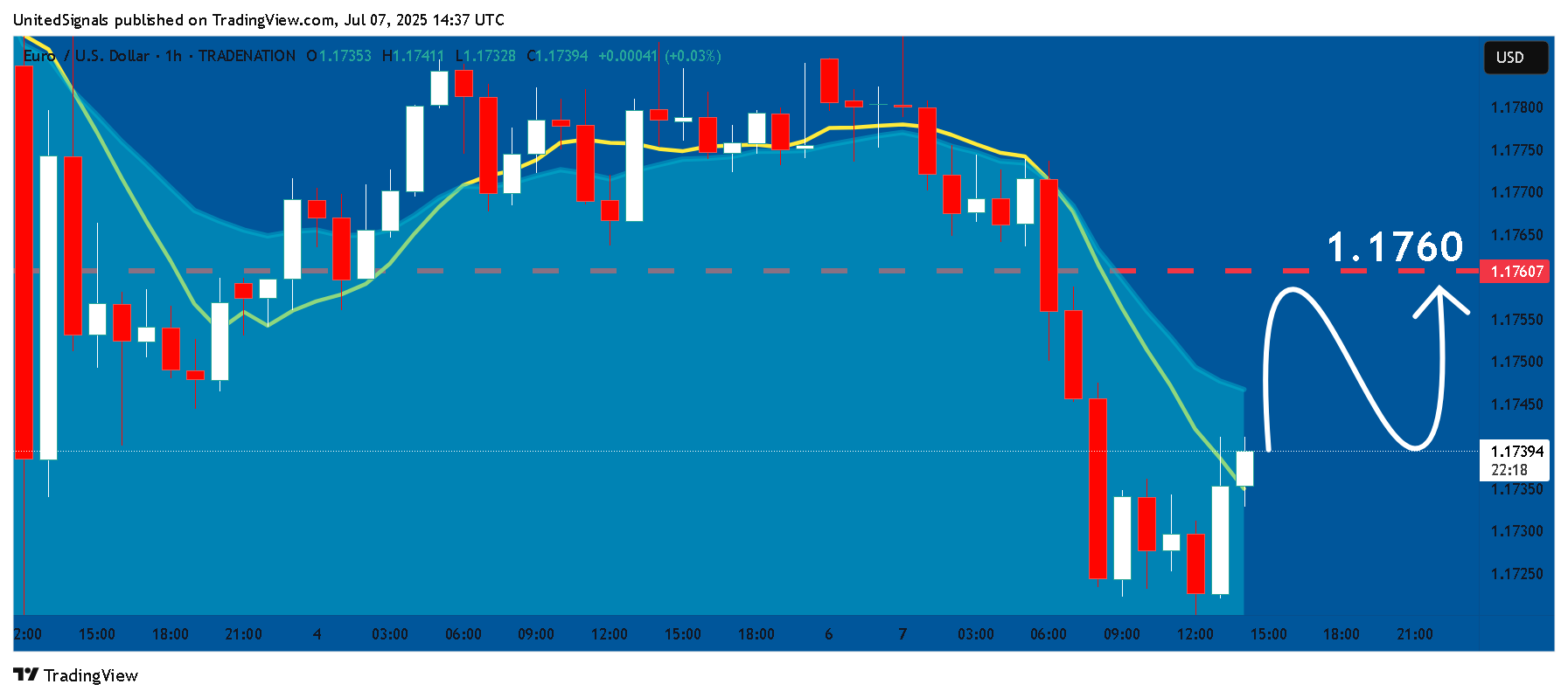 TRADENATION:EURUSD Chart Image by UnitedSignals