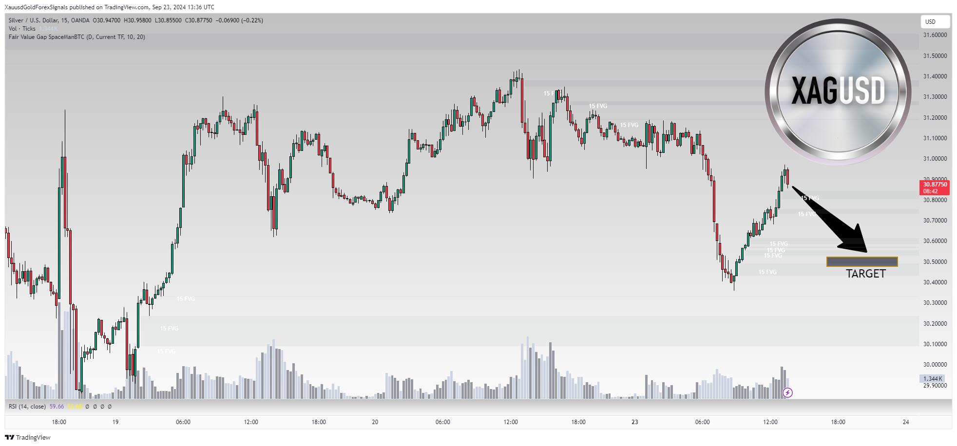 OANDA:XAGUSD Chart Image by XauusdGoldForexSignals