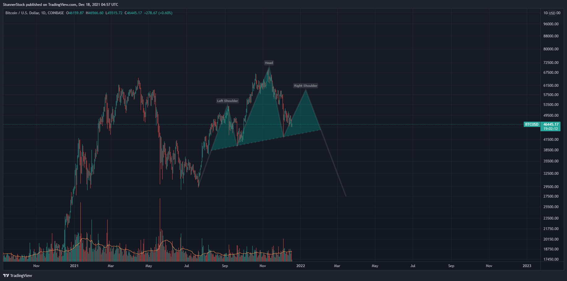 COINBASE:BTCUSD Chart Image by StunnerStock