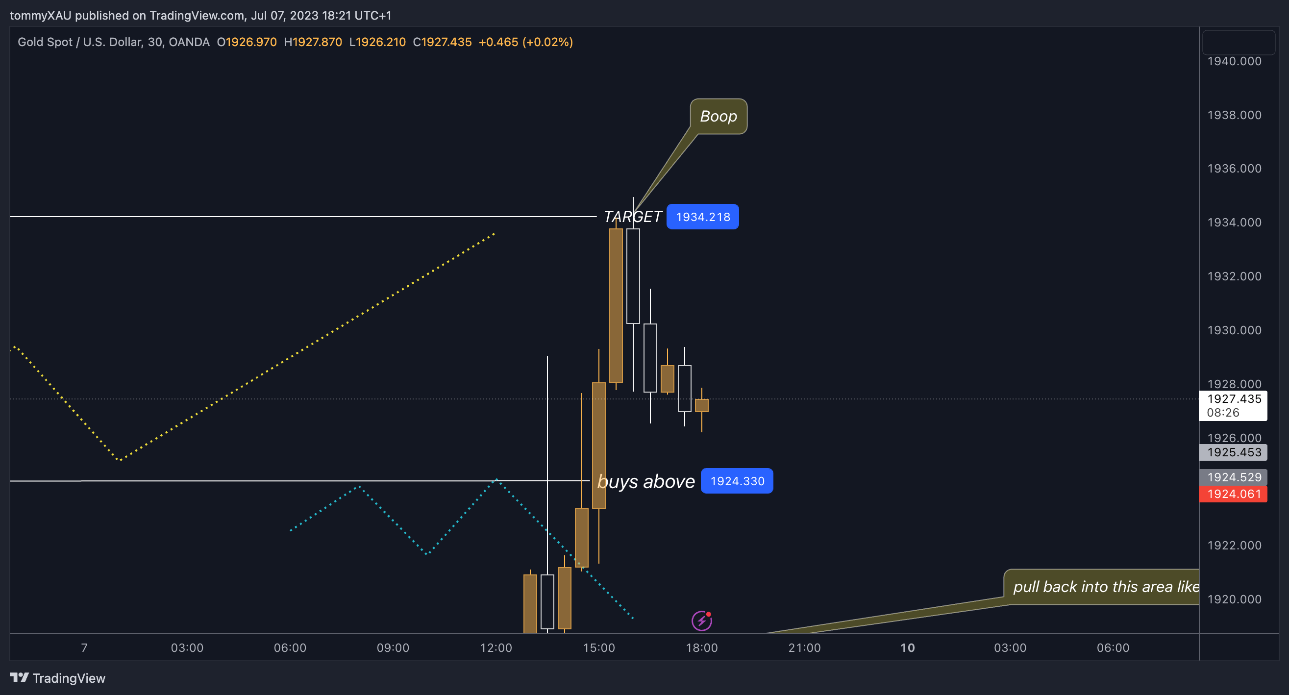 OANDA:XAUUSD Chart Image by tommyXAU