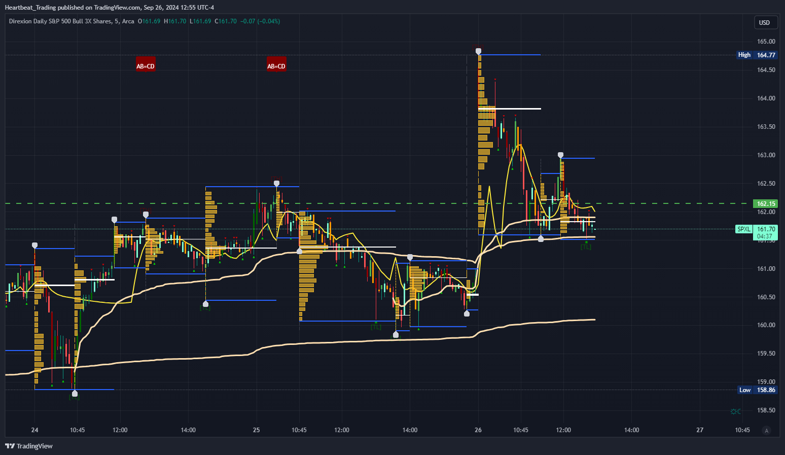 BATS:SPXL Chart Image by Heartbeat_Trading