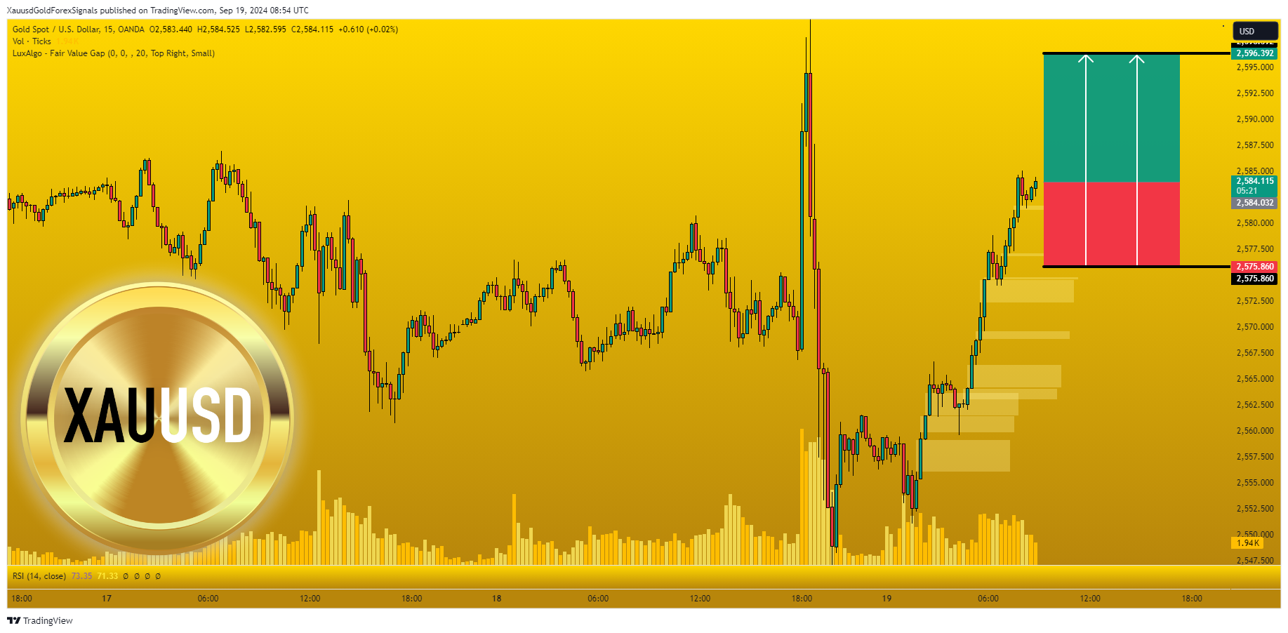 OANDA:XAUUSD Chart Image by XauusdGoldForexSignals