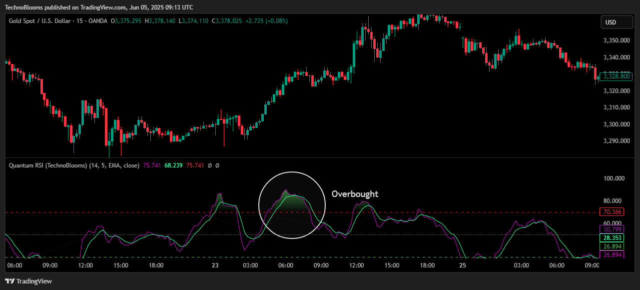 OANDA:XAUUSD Chart Image by TechnoBlooms