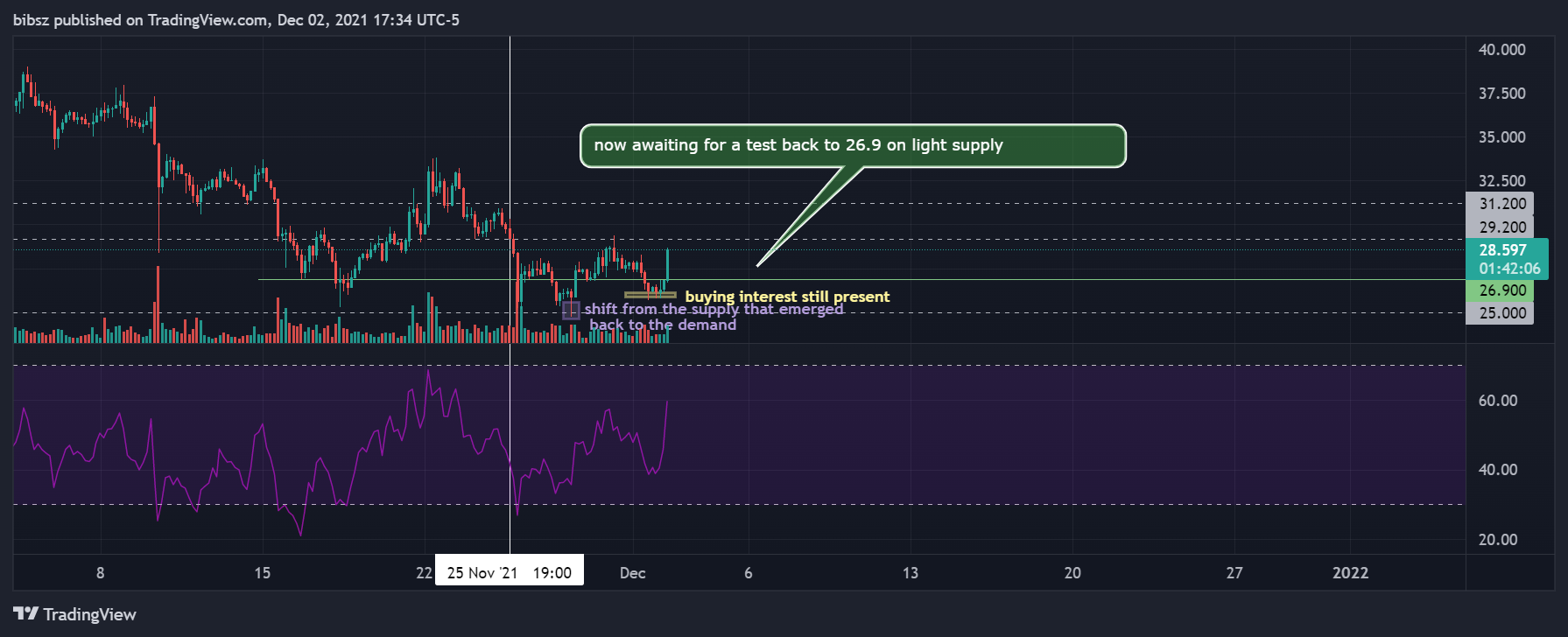 COINBASE:ATOMUSD Chart Image by bibsz