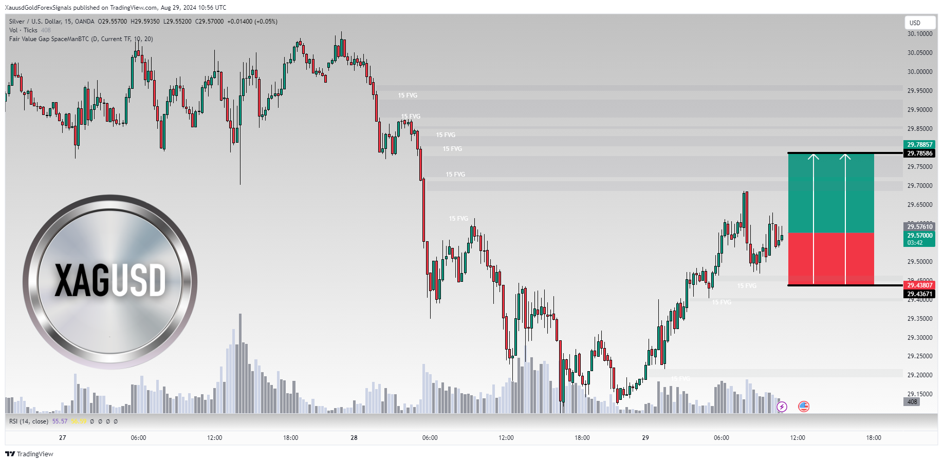 OANDA:XAGUSD Chart Image by XauusdGoldForexSignals