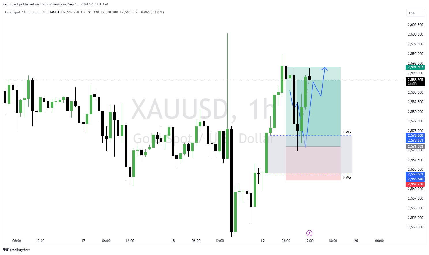 OANDA:XAUUSD Chart Image by Kacim_ict