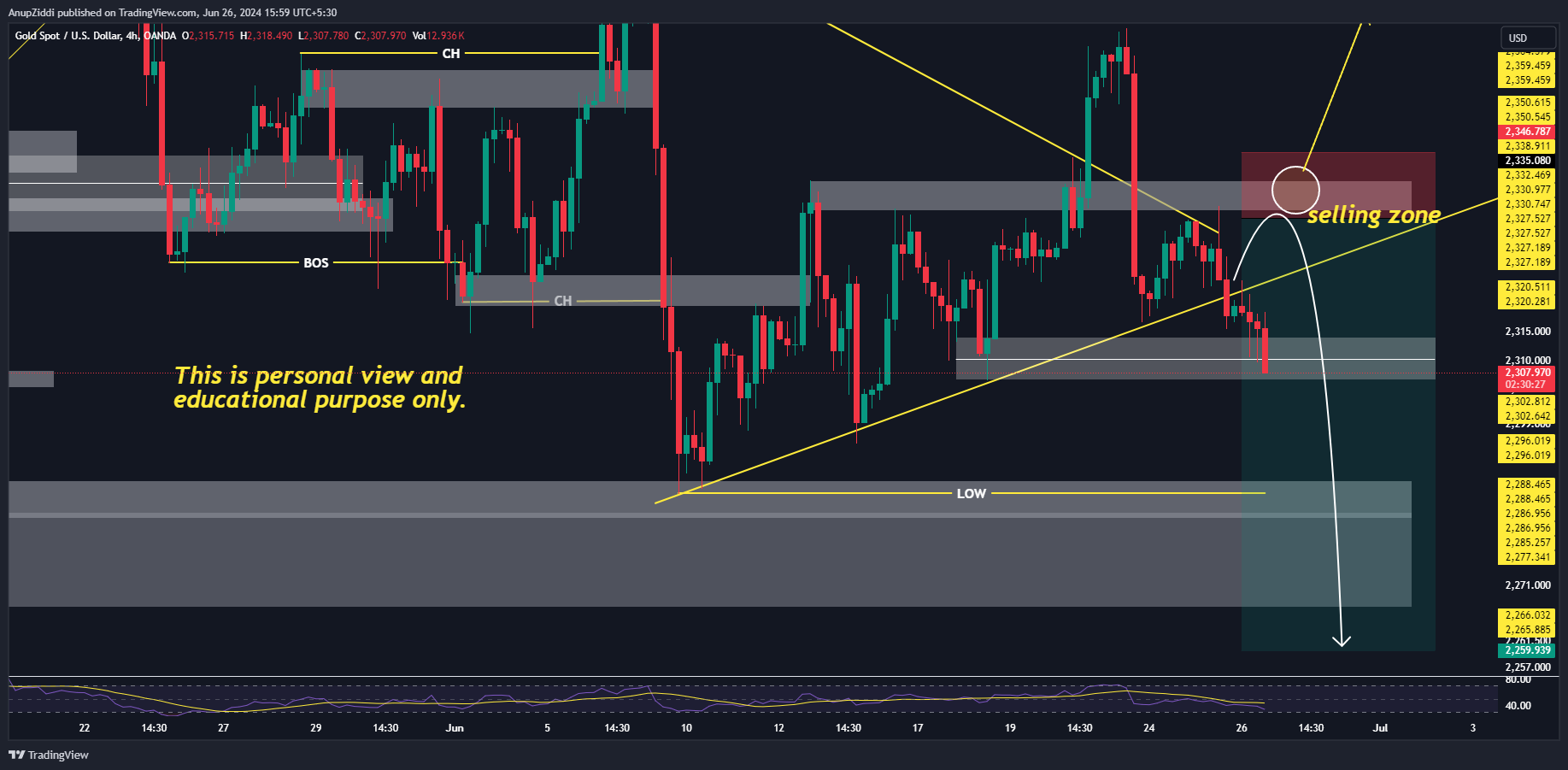 OANDA:XAUUSD Chart Image by AnupZiddi