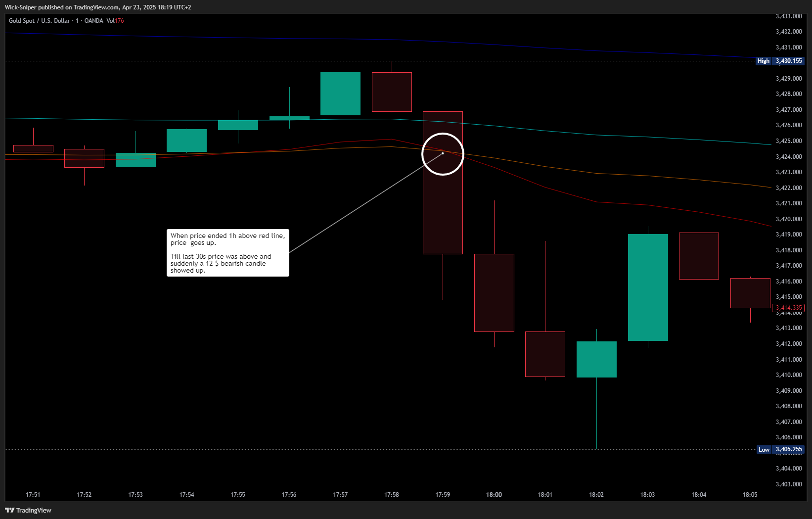 OANDA:XAUUSD Chart Image by Wick-Sniper