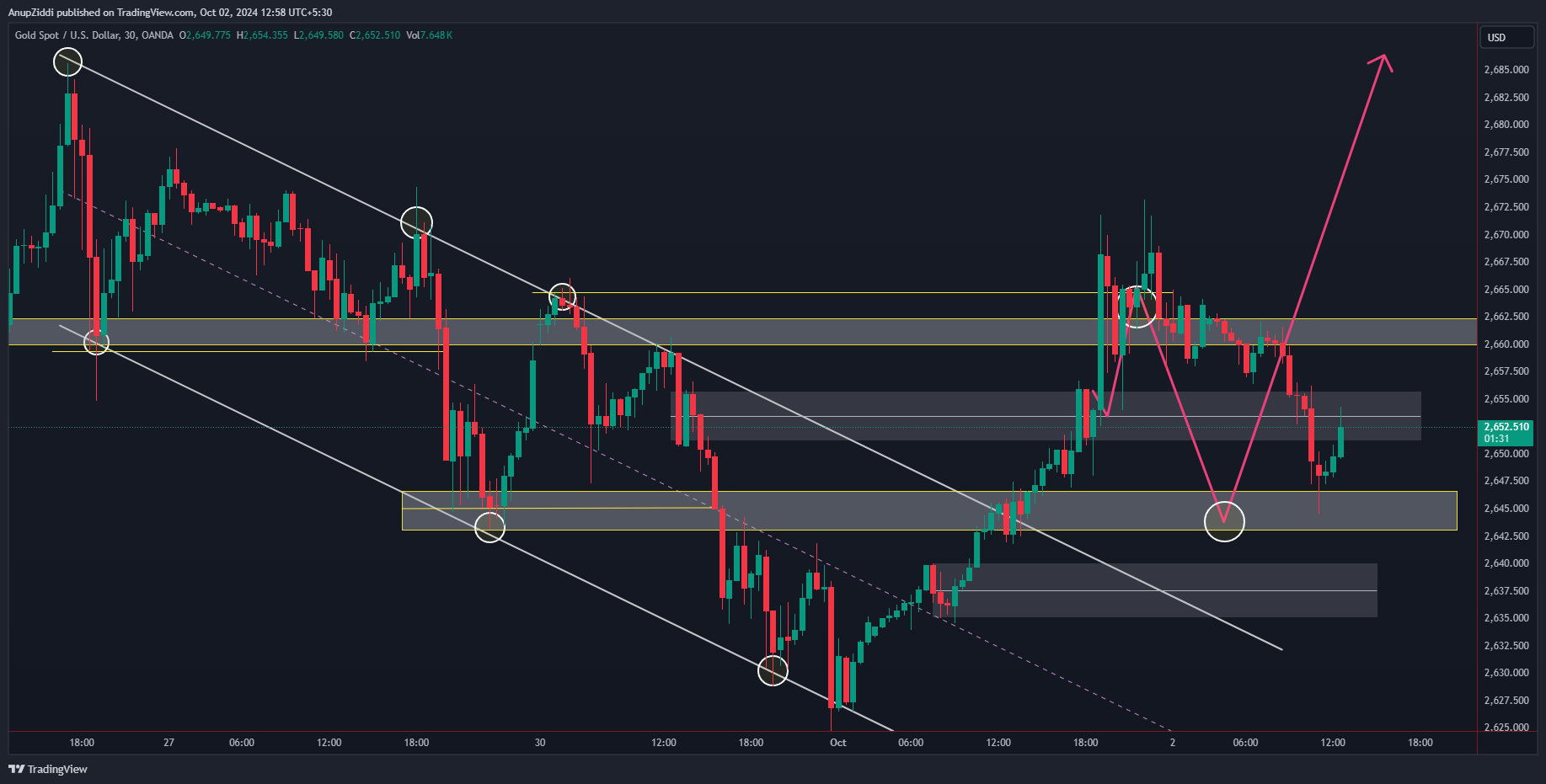 OANDA:XAUUSD Chart Image by AnupZiddi