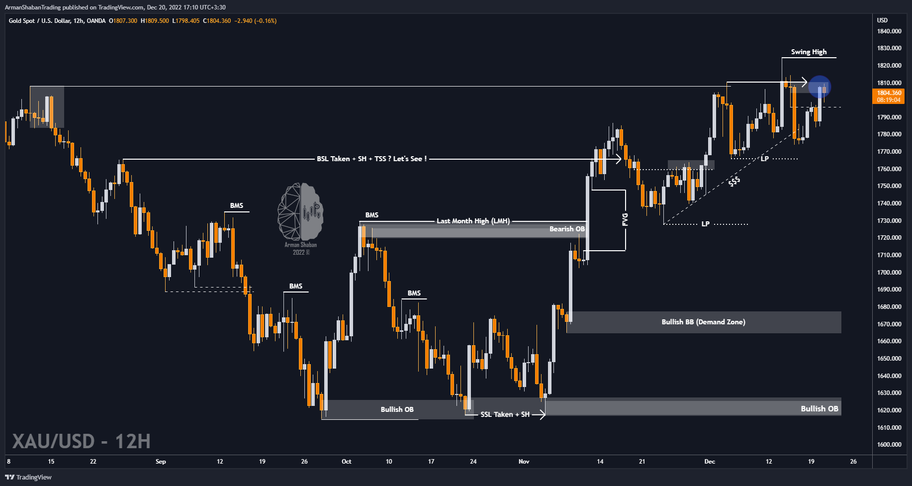 OANDA:XAUUSD Chart Image by ArmanShabanTrading
