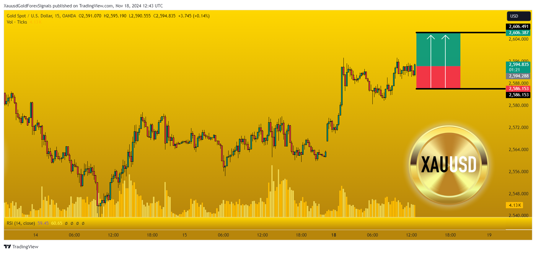 OANDA:XAUUSD Chart Image by XauusdGoldForexSignals