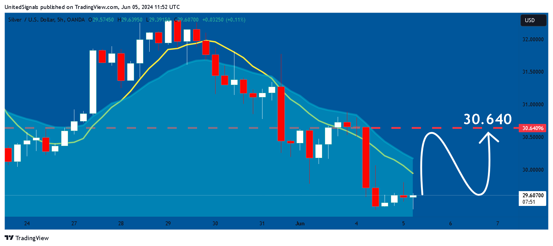 OANDA:XAGUSD Chart Image by UnitedSignals