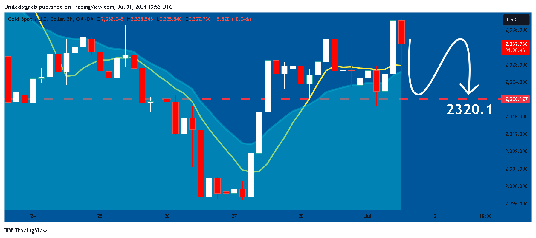 OANDA:XAUUSD Chart Image by UnitedSignals