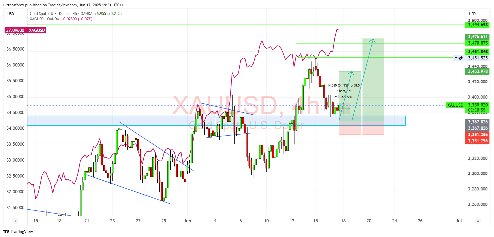 OANDA:XAUUSD Chart Image by ultreosforex
