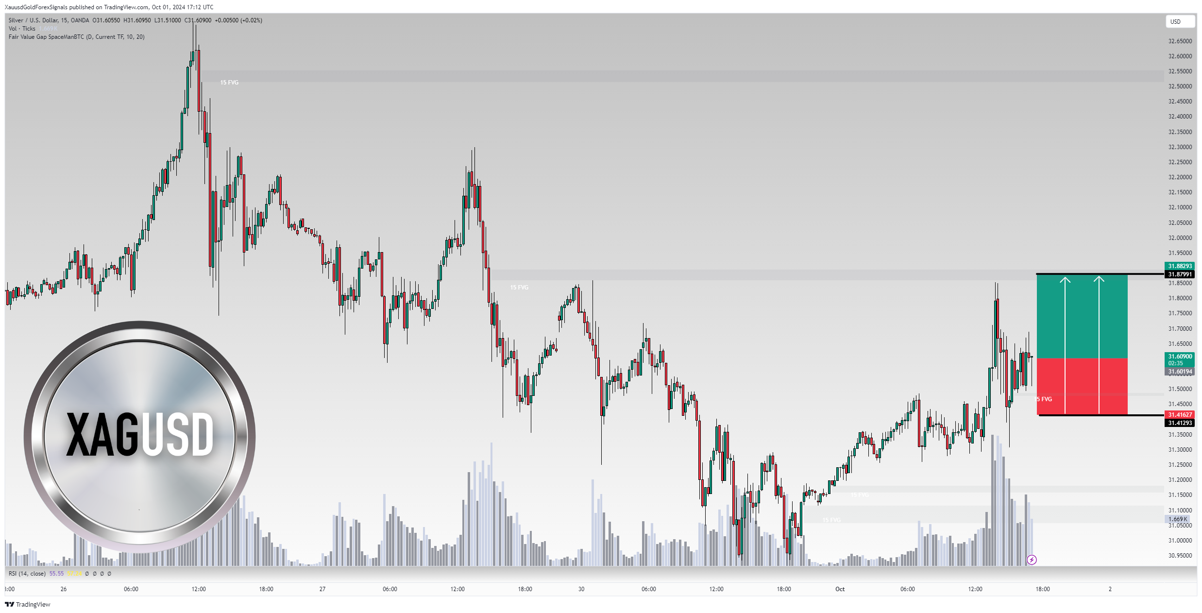 OANDA:XAGUSD Chart Image by XauusdGoldForexSignals