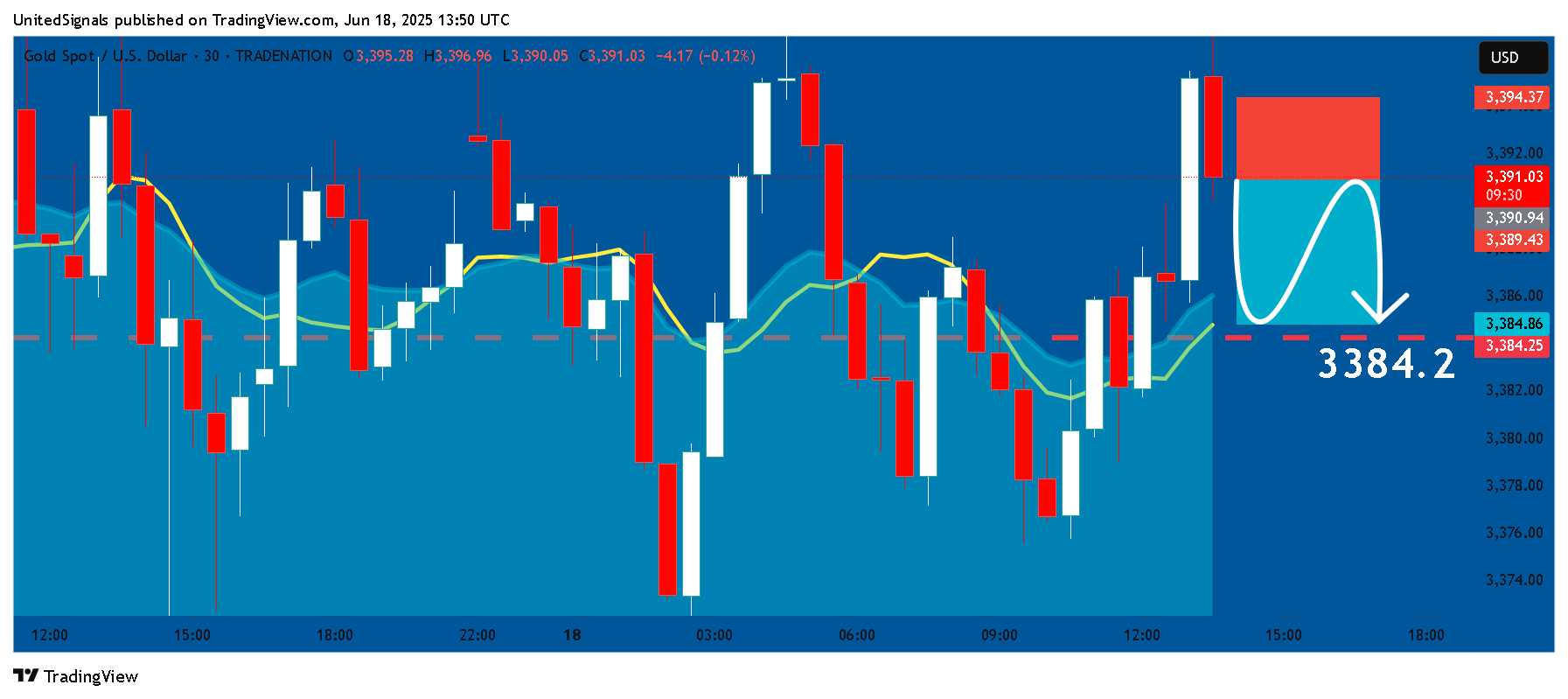 TRADENATION:XAUUSD Chart Image by UnitedSignals