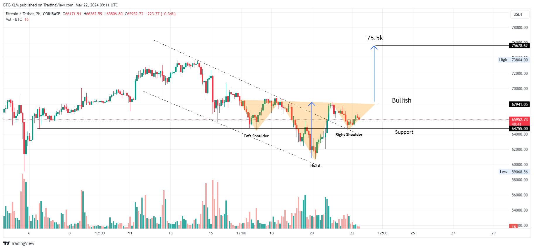COINBASE:BTCUSDT Chart Image by BTC-XLM