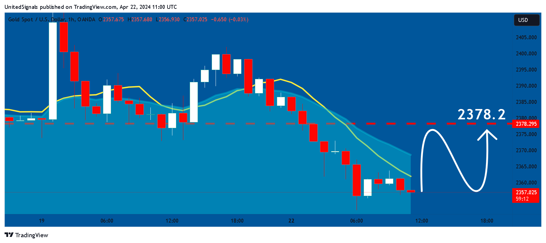 OANDA:XAUUSD Chart Image by UnitedSignals