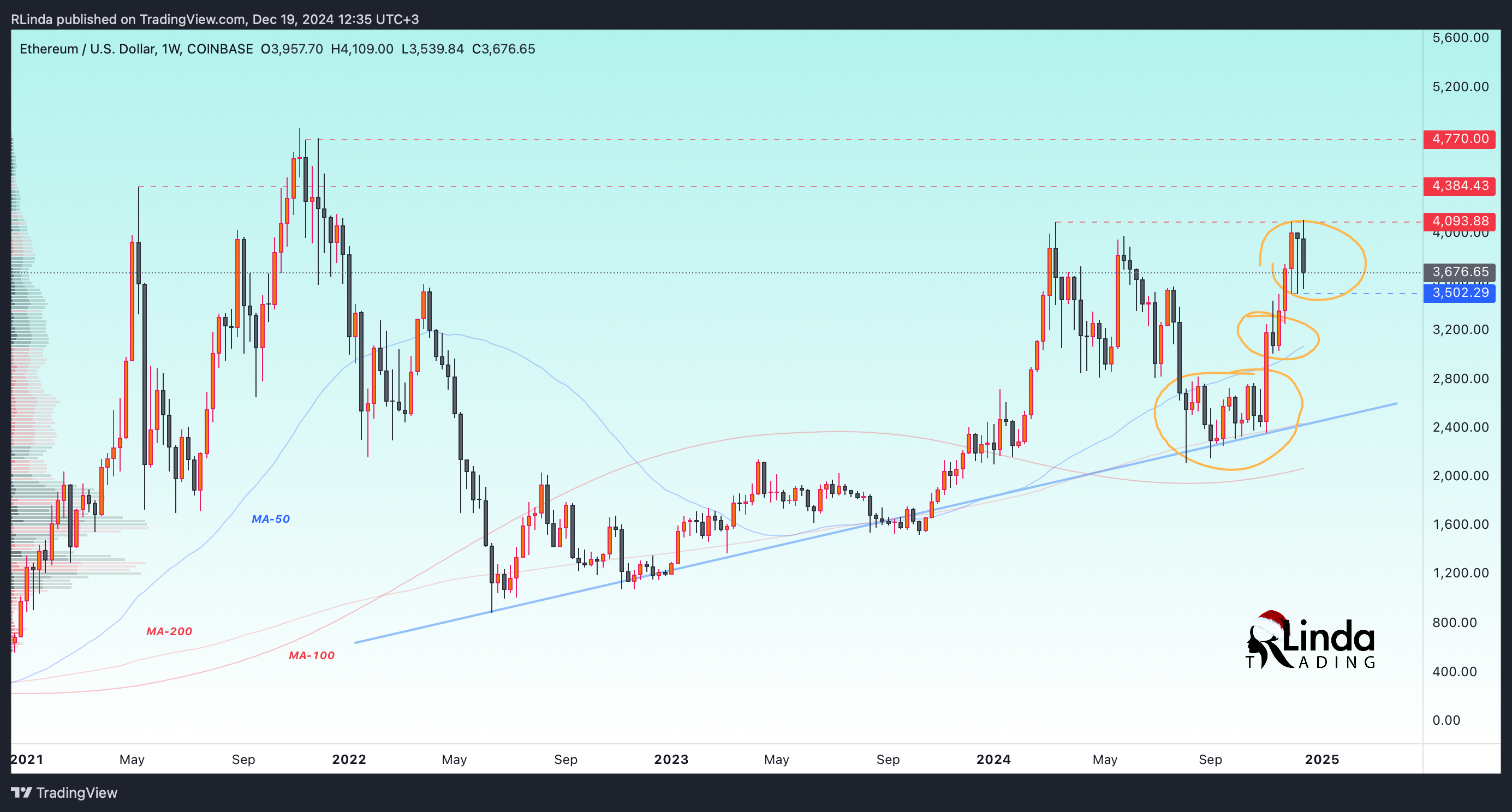 COINBASE:ETHUSD Chart Image by RLinda