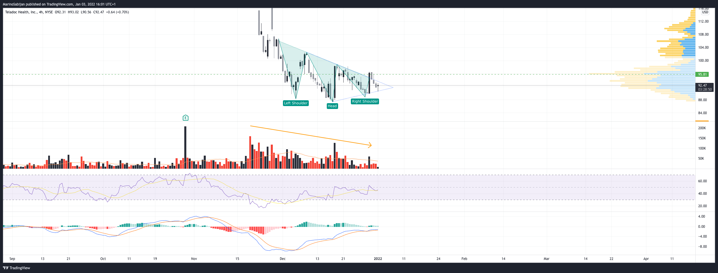 NYSE:TDOC Chart Image by MarinoSabijan