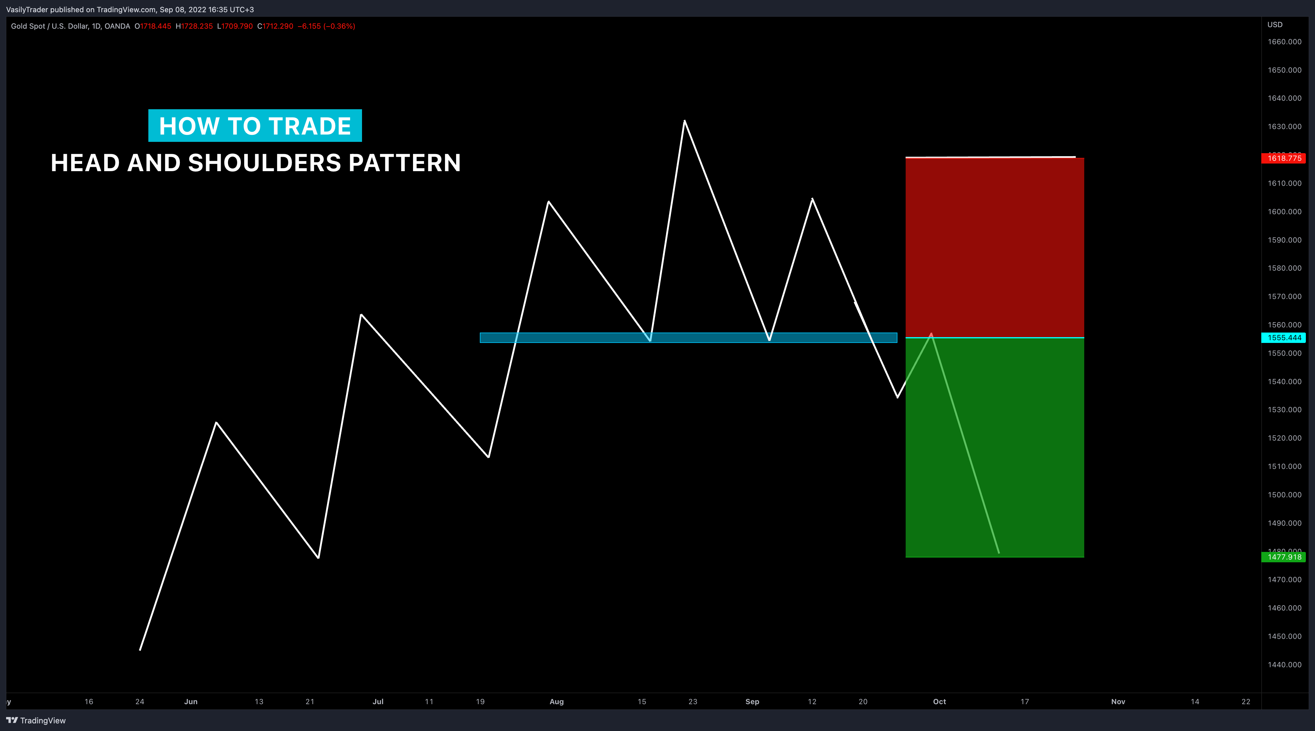 OANDA:XAUUSD Chart Image by VasilyTrader