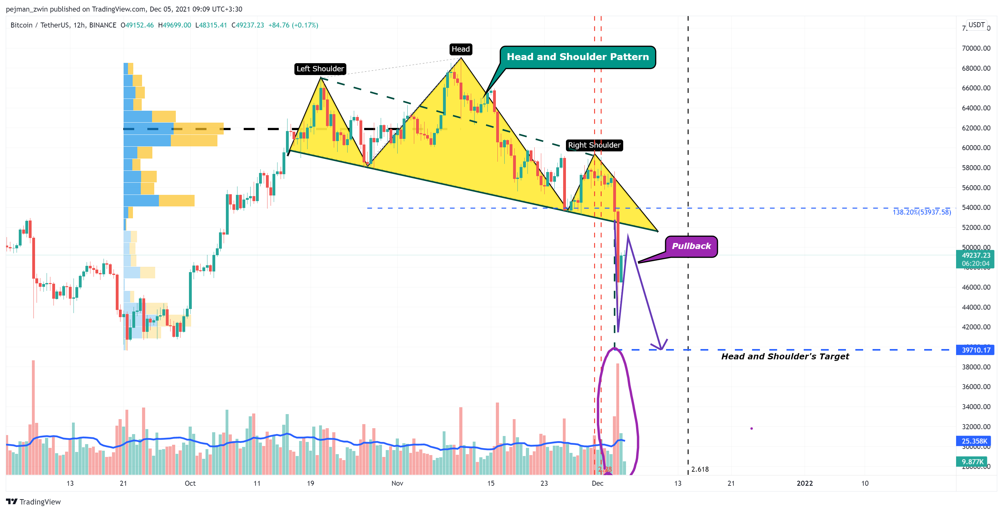 BINANCE:BTCUSDT Chart Image by pejman_zwin