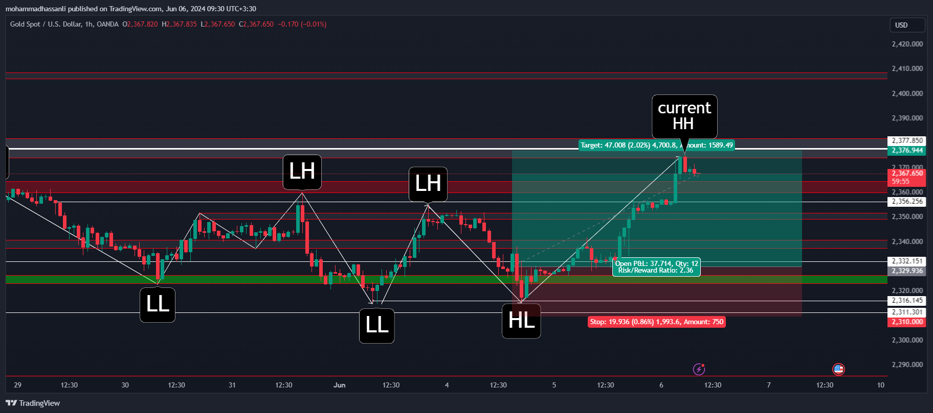 OANDA:XAUUSD Chart Image by mohammadhassanli