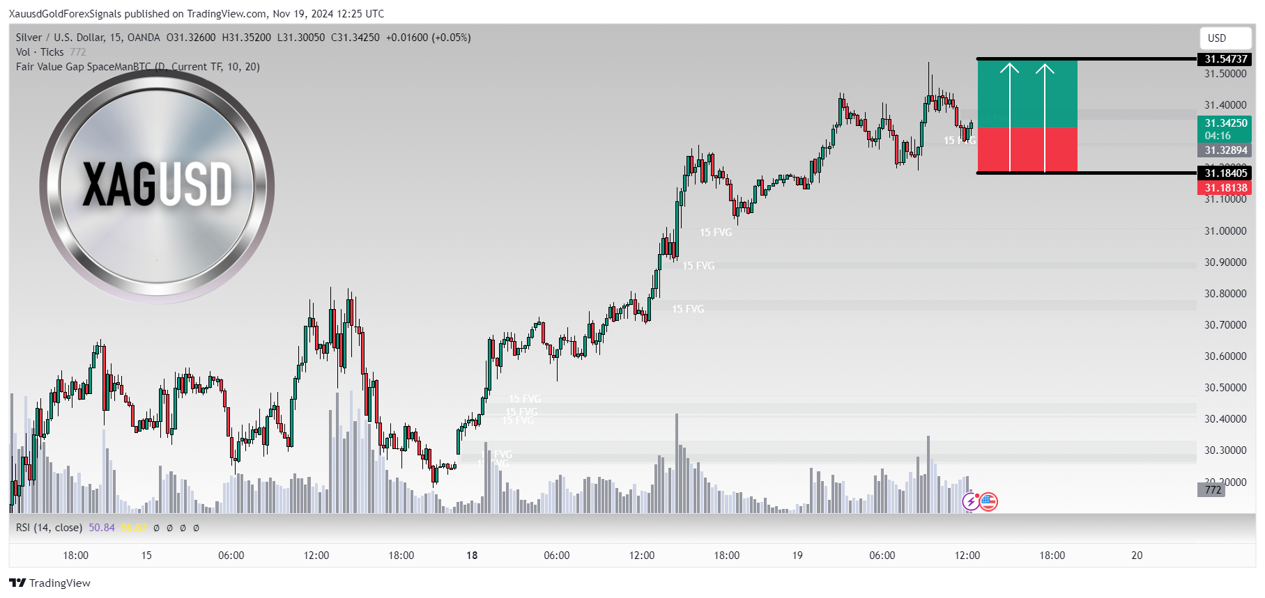 OANDA:XAGUSD Chart Image by XauusdGoldForexSignals
