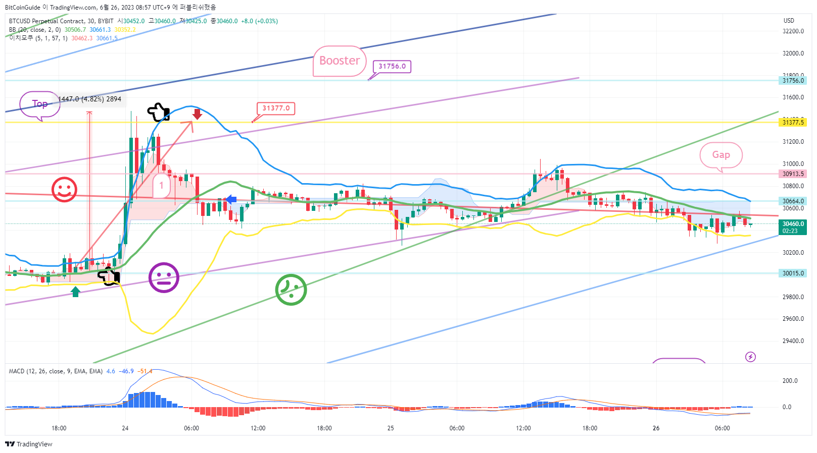 BYBIT:BTCUSD.P Chart Image by BitCoinGuide