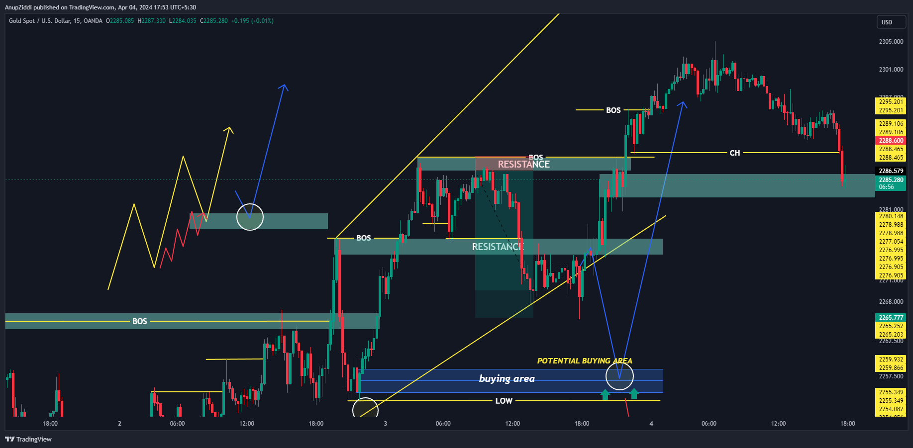 OANDA:XAUUSD Chart Image by AnupZiddi