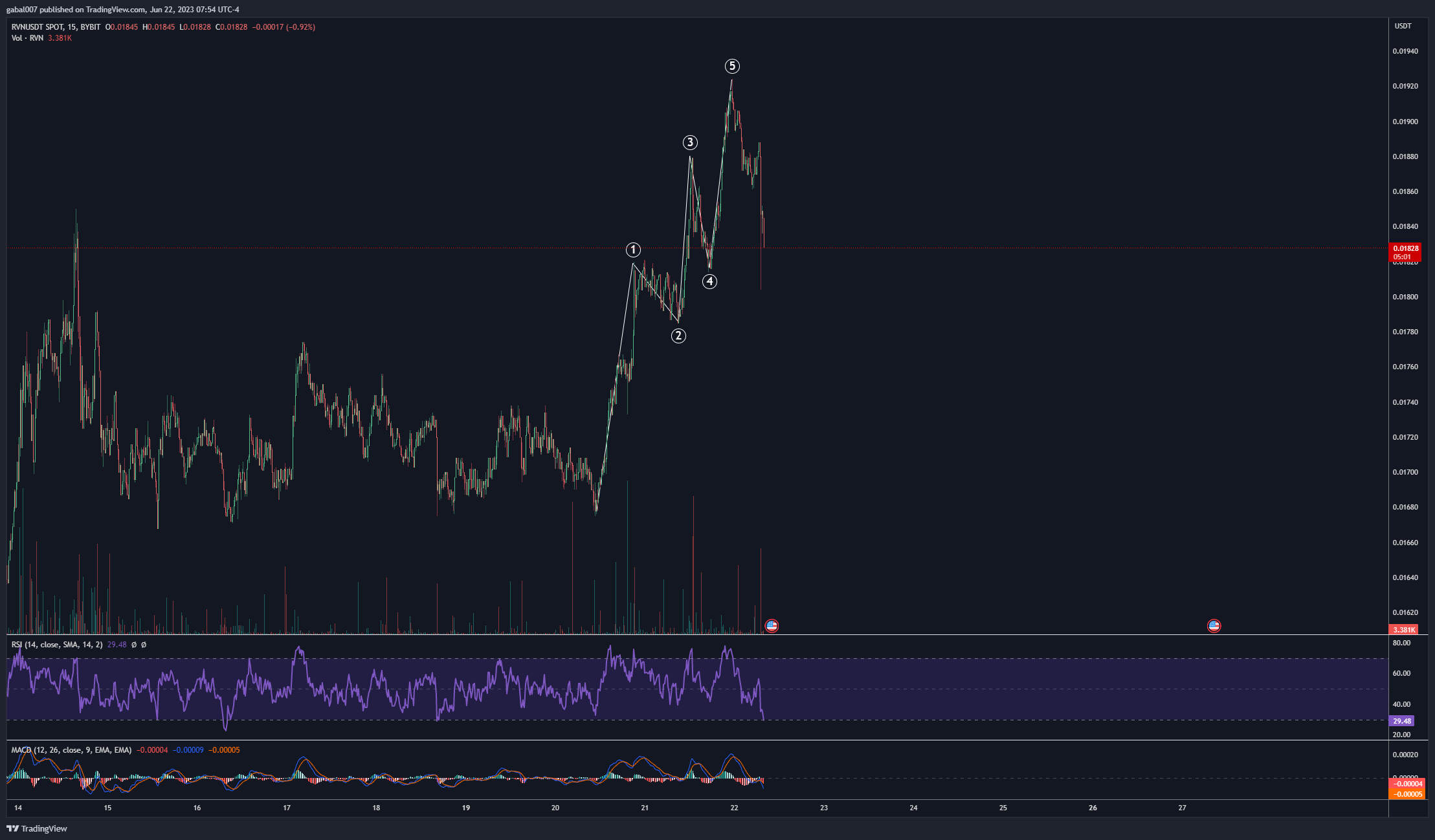 BYBIT:RVNUSDT Chart Image by gabal007