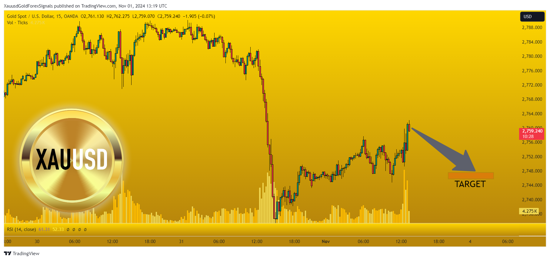 OANDA:XAUUSD Chart Image by XauusdGoldForexSignals