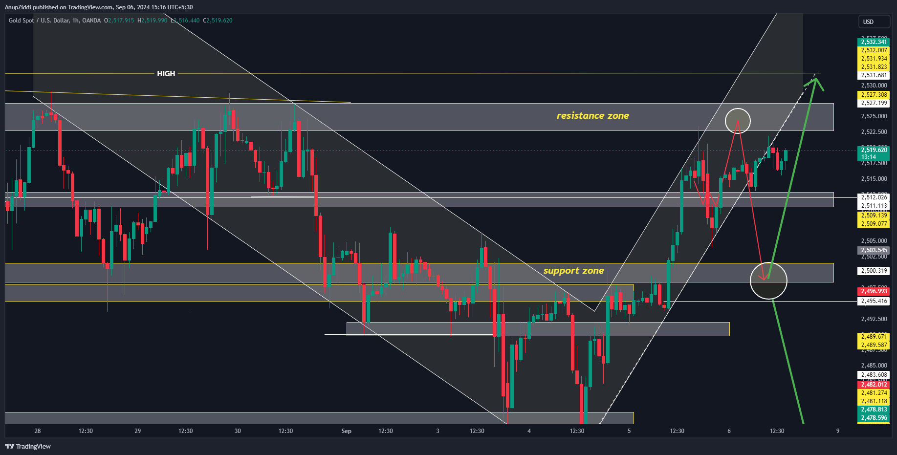 OANDA:XAUUSD Chart Image by AnupZiddi