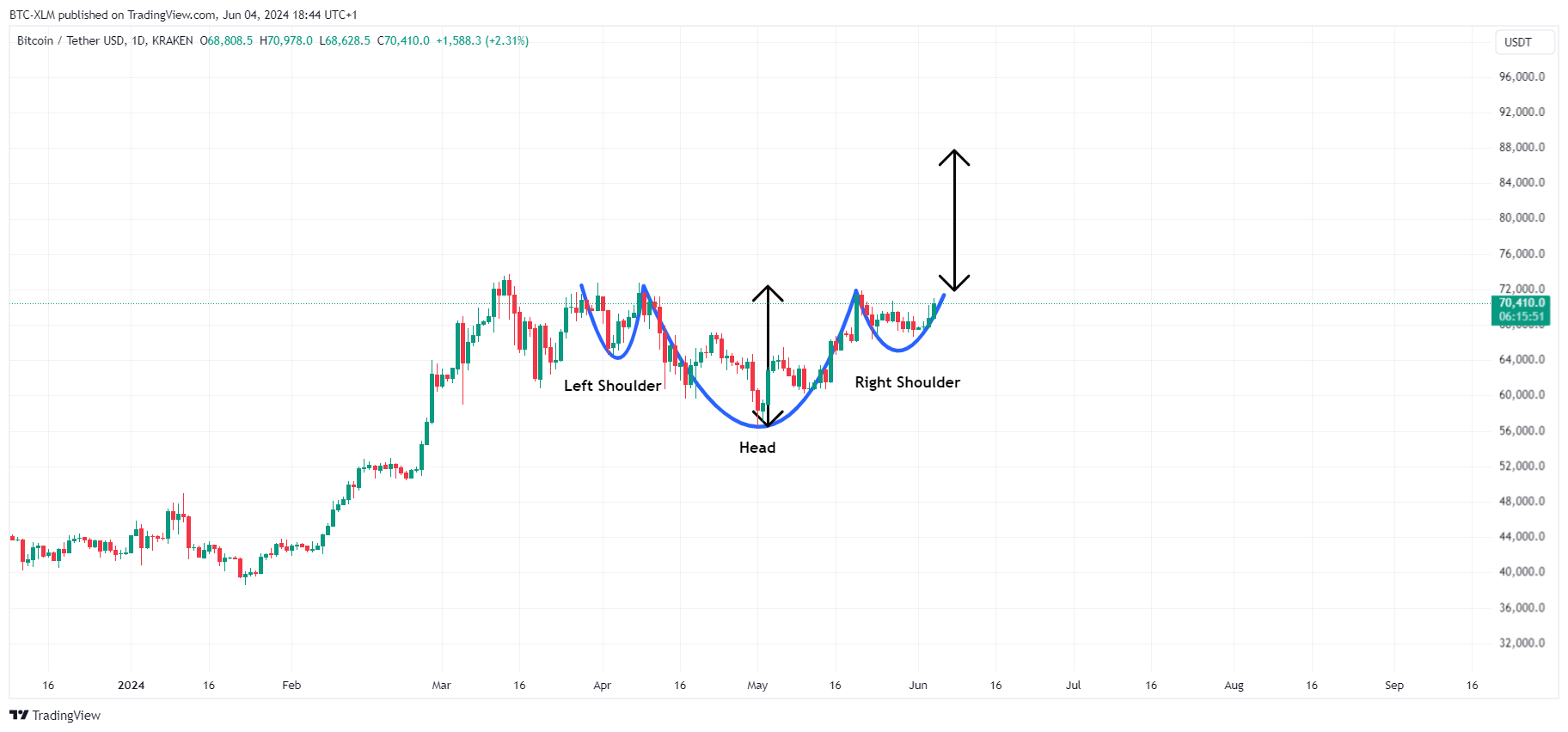 KRAKEN:BTCUSDT Chart Image by BTC-XLM