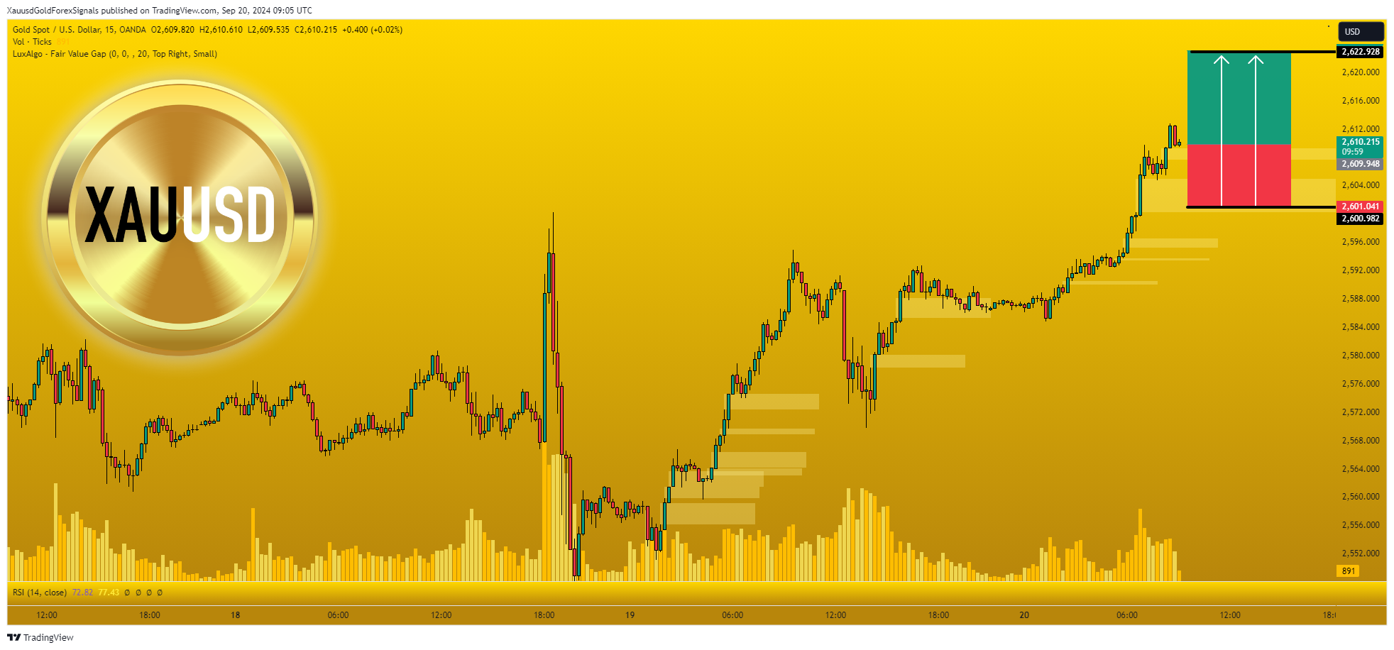 OANDA:XAUUSD Chart Image by XauusdGoldForexSignals