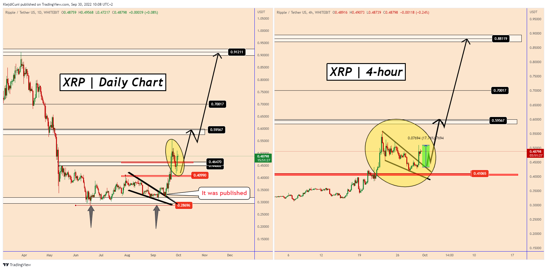 WHITEBIT:XRPUSDT Chart Image by KlejdiCuni