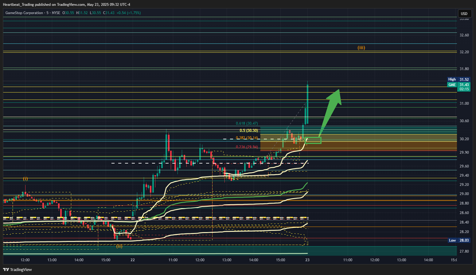 BATS:GME Chart Image by Heartbeat_Trading