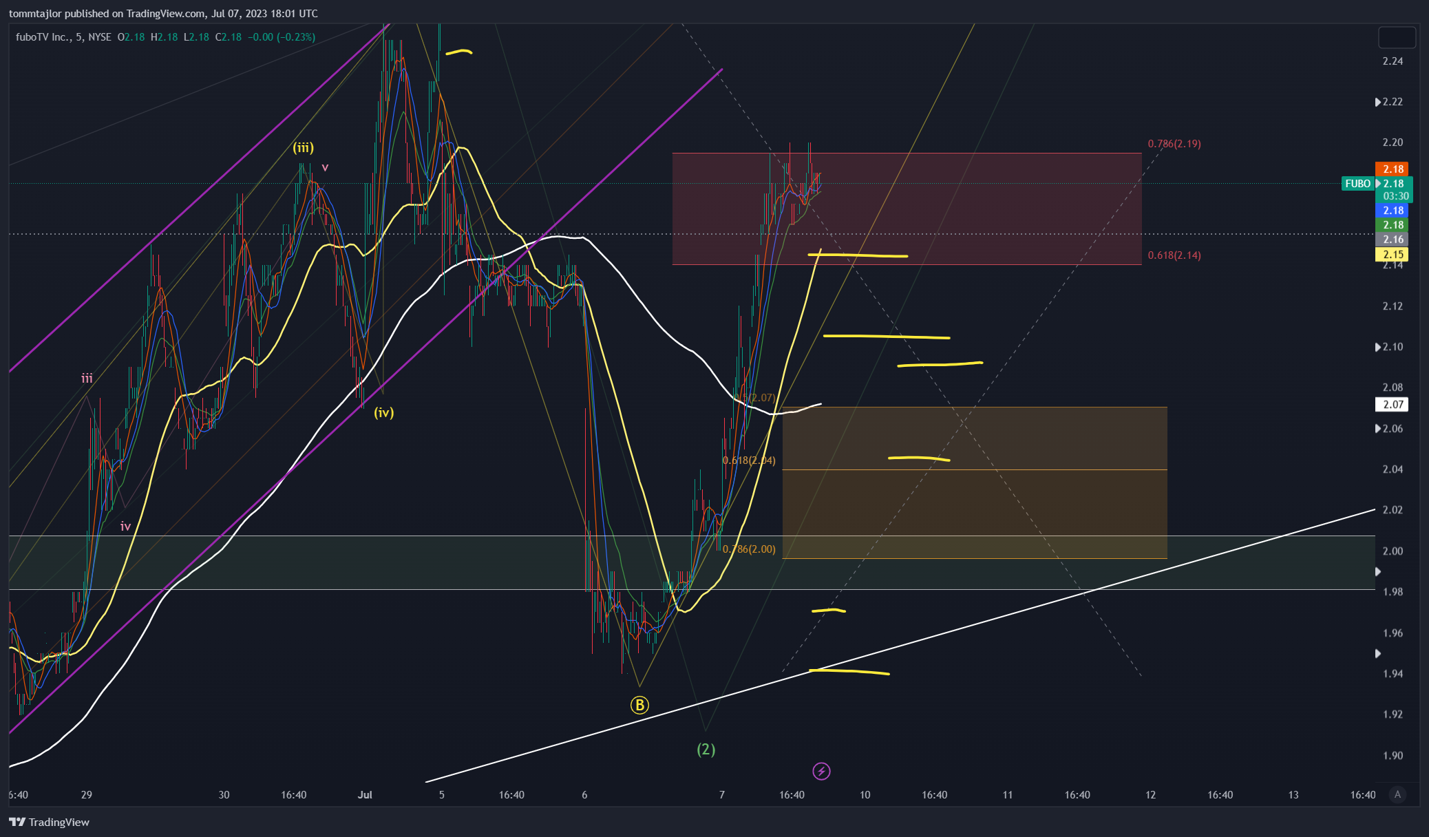 NYSE:FUBO Chart Image by tommtajlor
