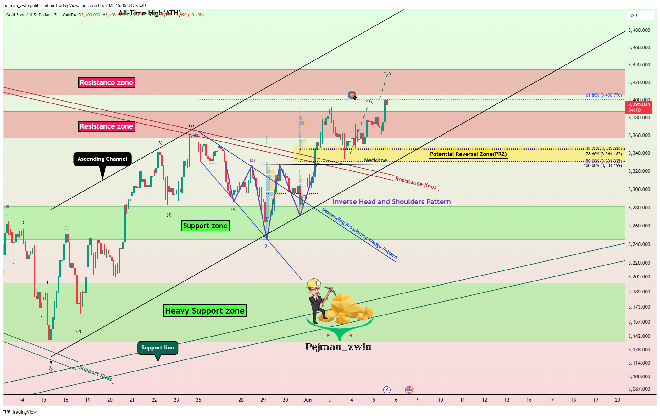 OANDA:XAUUSD Chart Image by pejman_zwin
