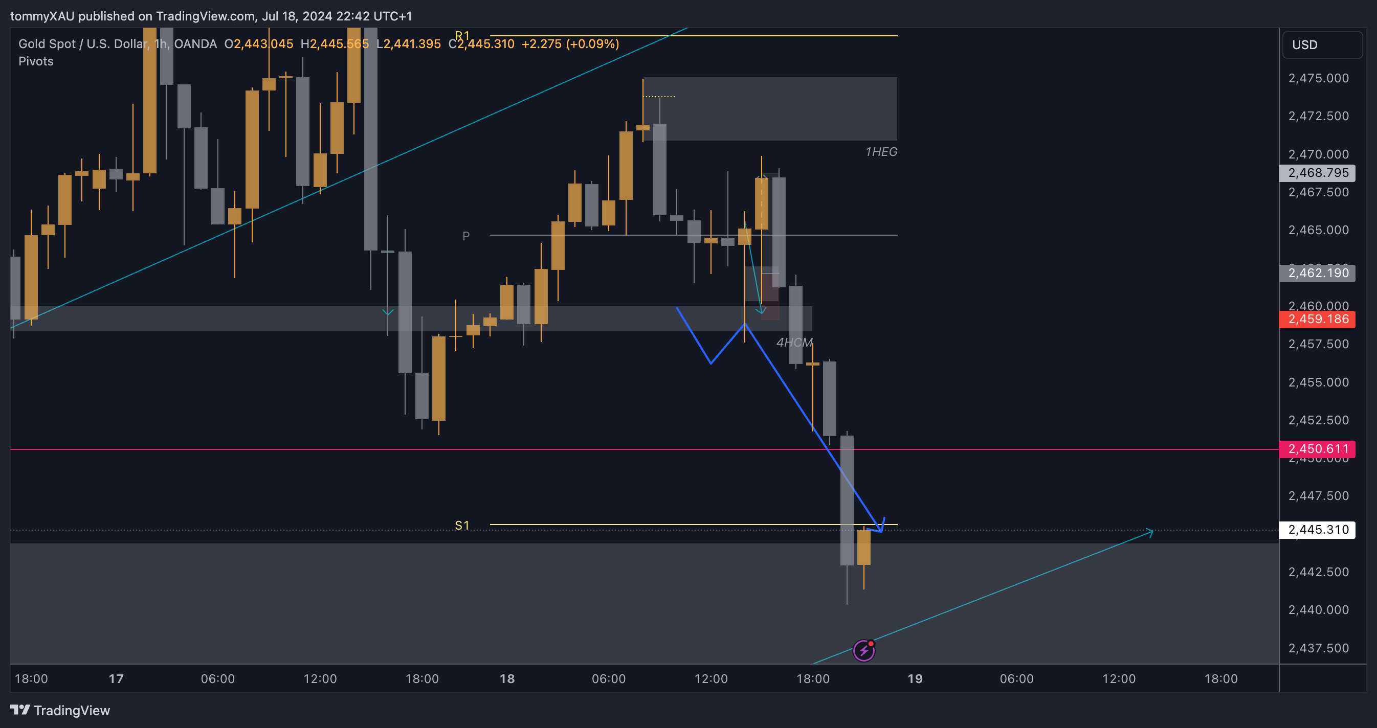 OANDA:XAUUSD Chart Image by tommyXAU