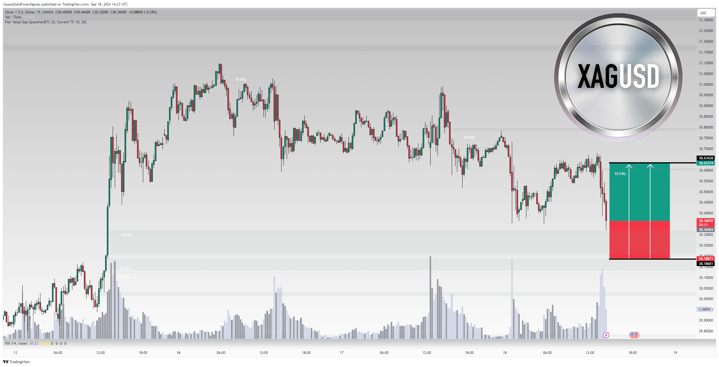 OANDA:XAGUSD Chart Image by XauusdGoldForexSignals