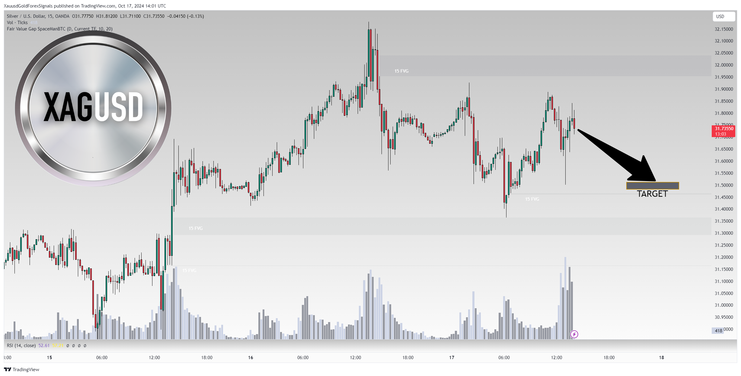 OANDA:XAGUSD Chart Image by XauusdGoldForexSignals