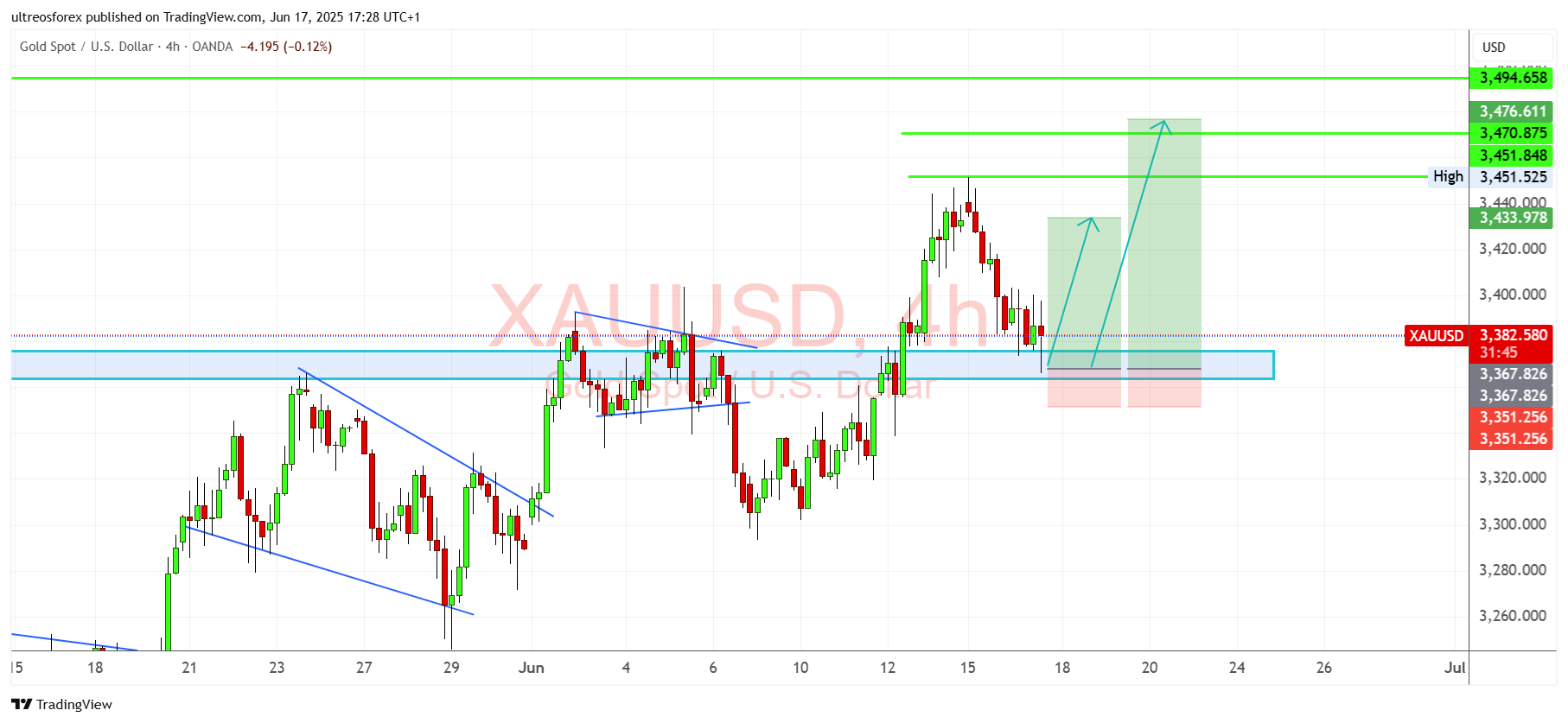 OANDA:XAUUSD Chart Image by ultreosforex